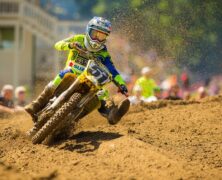 JUSTIN BARCIA UNDERGO THUMB SURGICAL TREATMENT